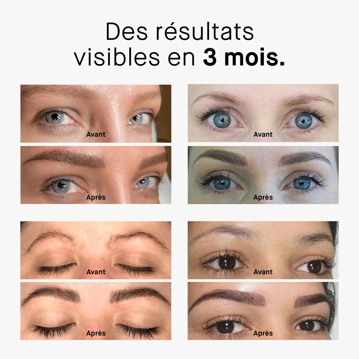 ROSEBROW ADVANCED