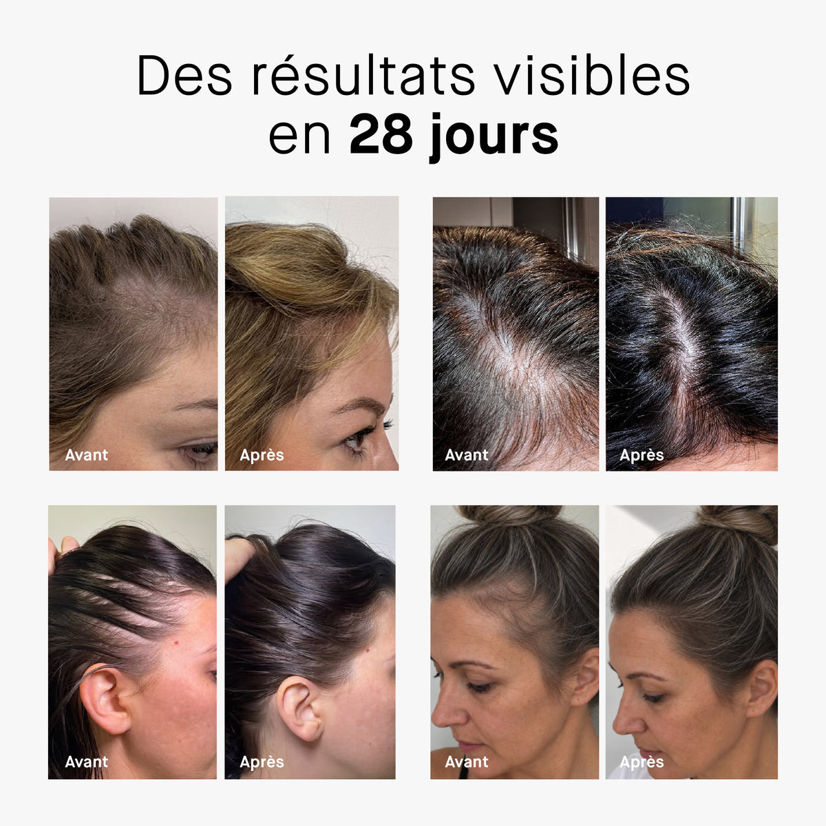 ROSEHAIR ADVANCED