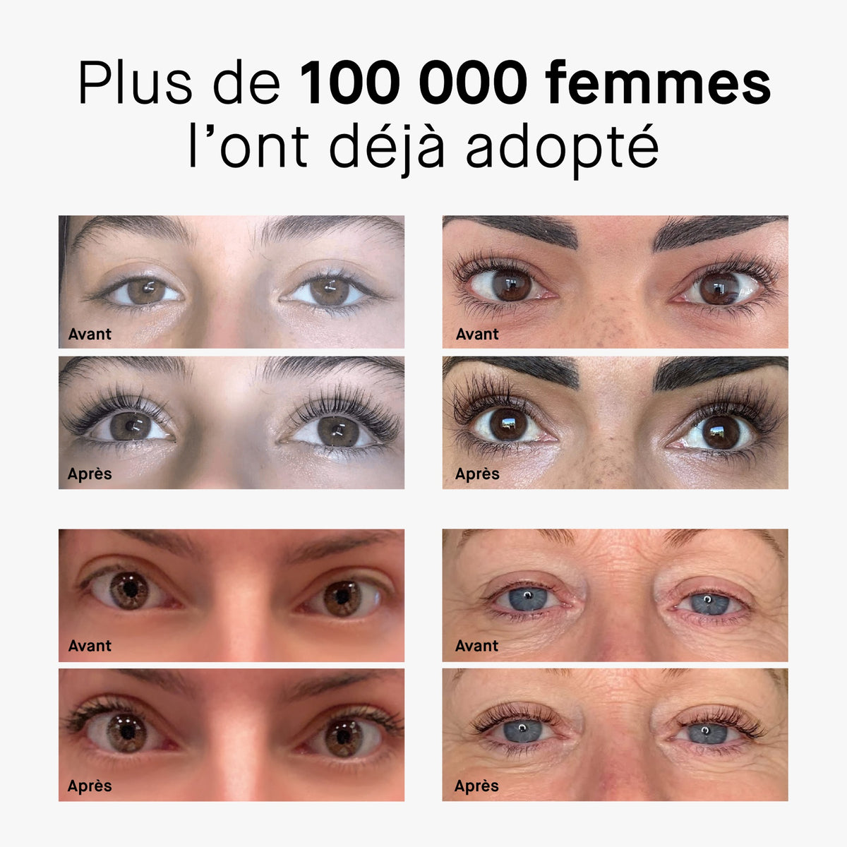 Avant / après — plus de 100 000 femmes l'ont déjà adopté